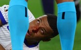Chùm ảnh: Mbappe gãy xương mũi, phải đeo mặt nạ ở EURO 2024 