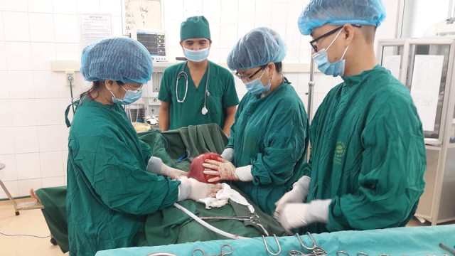 Các bác sĩ phẫu thuật khối u xơ nặng 2kg cho bệnh nhân Nguyễn Thị H.