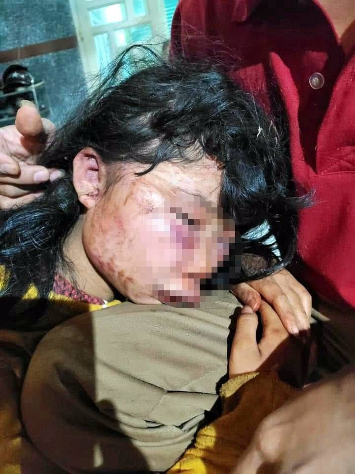 Nữ sinh M. bị đánh dã man trên đường đi học về. Ảnh: NLĐ