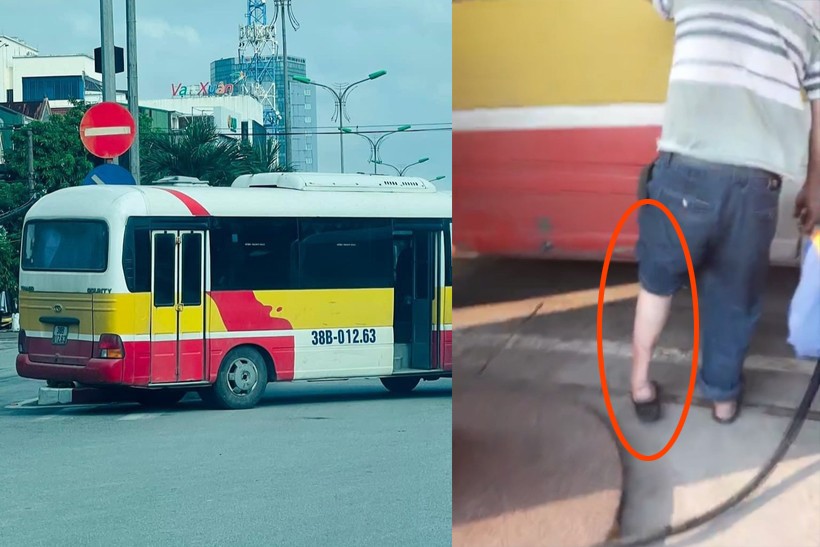 Chân của tài xế xe buýt "nhái" bị khuyết tật nhưng vẫn thường xuyên điều khiển phương tiện vận chuyển hành khách.