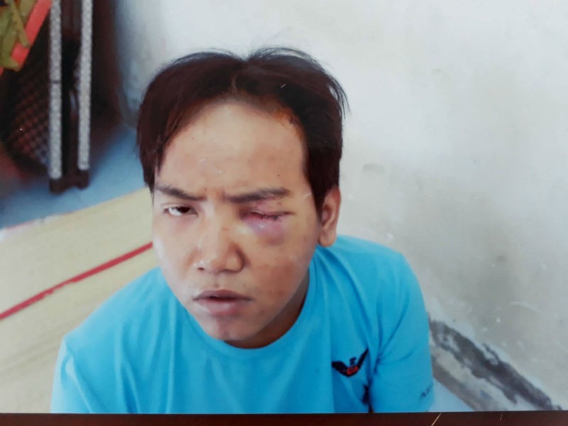  Nghi can Giang trong vụ bảo vệ dân phố vung dao lam sát hại bé 6 tuổi giữa phố.